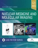 Lilja B Solnes, Harvey A. Ziessman - Nuclear Medicine and Molecular Imaging: Case Review Series, Häftad