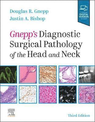 bokomslag Gnepp's Diagnostic Surgical Pathology of the Head and Neck