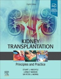 bokomslag Kidney Transplantation - Principles and Practice