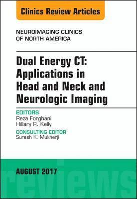 Dual Energy CT: Applications in Head and Neck and Neurologic Imaging, An Issue of Neuroimaging Clinics of North America 1