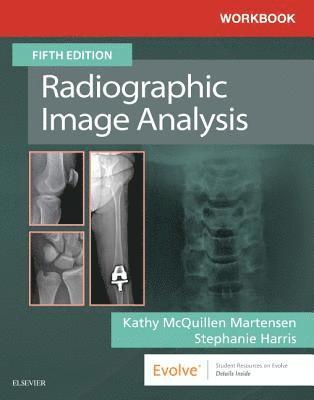 Iowa) McQuillen-Martensen, Kathy, MA, RT(R) (Director of Radiologic Technology Education, Department of Radiology, The University of Iowa Hospitals and Clinics, Iowa City - Workbook for Radiographic Image Analysis, Häftad
