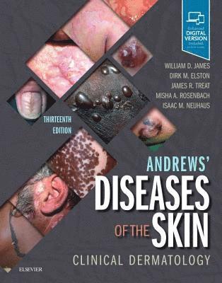 bokomslag Andrews' Diseases of the Skin