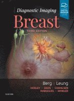 Wendie A. Berg, Jessica Leung - Diagnostic Imaging: Breast, Inbunden