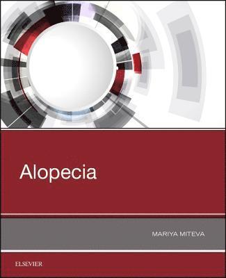 Alopecia 1