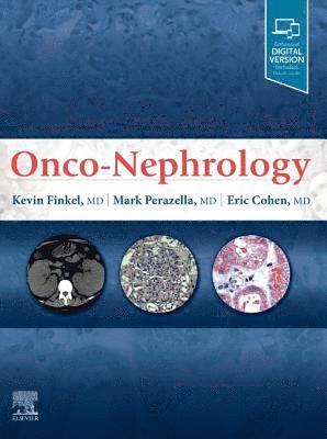 bokomslag Onco-Nephrology