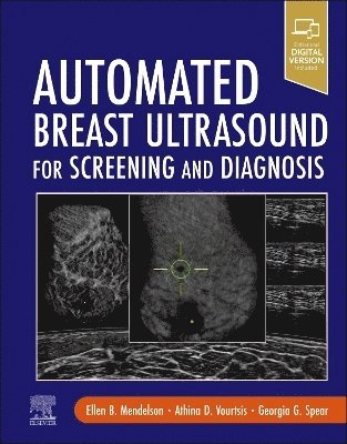 bokomslag Automated Breast Ultrasound for Screening and Diagnosis