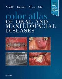 bokomslag Color Atlas of Oral and Maxillofacial Diseases