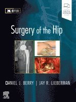 Daniel J. Berry, Jay Lieberman - Surgery of the Hip, Inbunden