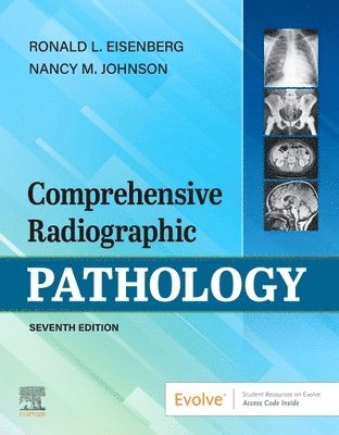 Ronald L. Eisenberg, Nancy M. Johnson - Comprehensive Radiographic Pathology, Häftad