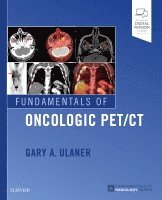 Gary A. Ulaner - Fundamentals of Oncologic PET/CT, Häftad