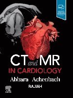 Suhny Abbara, Stephan Achenbach - CT and MR in Cardiology, Inbunden