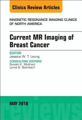 Current MR Imaging of Breast Cancer, An Issue of Magnetic Resonance Imaging Clinics of North America 1