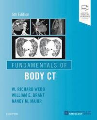 bokomslag Fundamentals of Body CT