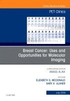 Elizabeth McDonald, Gary A. Ulaner - Breast Cancer: Uses and Opportunities for Molecular Imaging, An Issue of PET Clinics, Inbunden