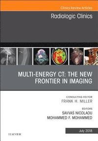 bokomslag Multi-Energy CT: The New Frontier in Imaging, An Issue of Radiologic Clinics of North America