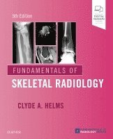 Clyde A. Helms, North Carolina) Helms, Clyde A. (Professor of Radiology and Orthopaedic Surgery, Deparment of Radiology, Duke University School of Medicine, Durham - Fundamentals of Skeletal Radiology, Häftad