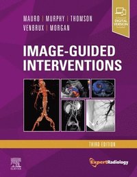 bokomslag Image-Guided Interventions