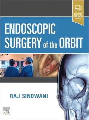 bokomslag Endoscopic Surgery of the Orbit