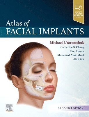 bokomslag Atlas of Facial Implants