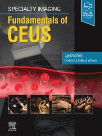 bokomslag Specialty Imaging: Fundamentals of CEUS