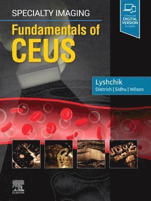 Specialty Imaging: Fundamentals of CEUS 1