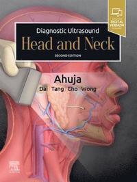 bokomslag Diagnostic Ultrasound: Head and Neck