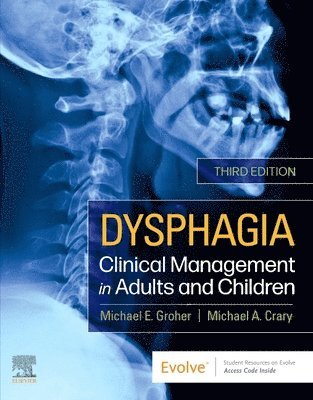 Dysphagia 1