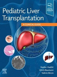 bokomslag Pediatric Liver Transplantation