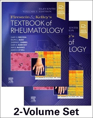 Gary S. Firestein, Ralph C. Budd, Sherine E Gabriel, Iain B. McInnes, James R. O'Dell, Gary Koretzky - Firestein & Kelley's Textbook of Rheumatology, 2-Volume Set, Inbunden