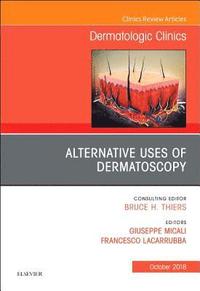 bokomslag Alternative Uses of Dermatoscopy, An Issue of Dermatologic Clinics