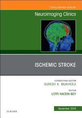 Ischemic Stroke, An Issue of Neuroimaging Clinics of North America 1