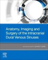 R. Shane Tubbs, R Shane Tubbs - Anatomy, Imaging and Surgery of the Intracranial Dural Venous Sinuses, Häftad