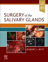 bokomslag Surgery of the Salivary Glands