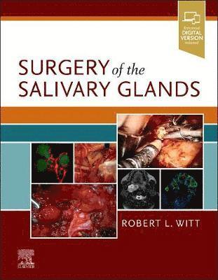 Surgery of the Salivary Glands 1