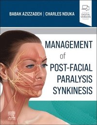 bokomslag Management of Post-Facial Paralysis Synkinesis