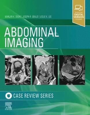 bokomslag Abdominal Imaging