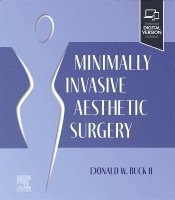 Donald W. Buck II - Minimally Invasive Aesthetic Surgery, Häftad