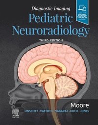 bokomslag Diagnostic Imaging: Pediatric Neuroradiology