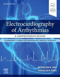 bokomslag Electrocardiography of Arrhythmias: A Comprehensive Review