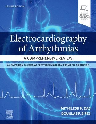 Electrocardiography of Arrhythmias: A Comprehensive Review 1