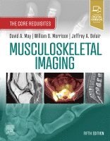 David A. May, William B. Morrison, Jeffrey A. Belair - Musculoskeletal Imaging, Häftad