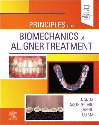 bokomslag Principles and Biomechanics of Aligner Treatment