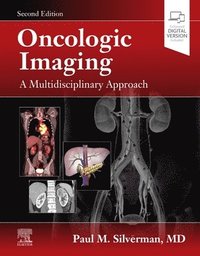 bokomslag Oncologic Imaging: A Multidisciplinary Approach