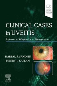 bokomslag Clinical Cases in Uveitis