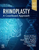Husain Ali Khan, Foad Nahai, Shahrokh C. Bagheri, Behnam Bohluli, James D. Frame - Rhinoplasty, Inbunden