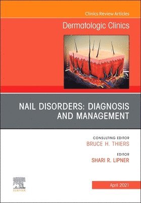 Nail Disorders: Diagnosis and Management, An Issue of Dermatologic Clinics 1