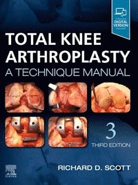 bokomslag Total Knee Arthroplasty