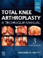 Richard D. Scott - Total Knee Arthroplasty, Inbunden