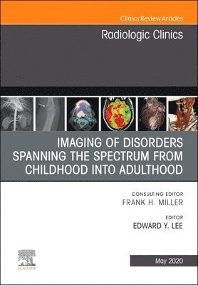 Imaging of Disorders Spanning the Spectrum from Childhood ,An Issue of Radiologic Clinics of North America 1