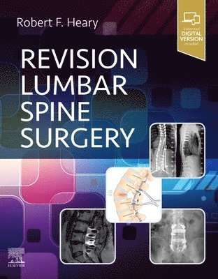 bokomslag Revision Lumbar Spine Surgery